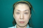 SEIN Aesthetic Plastic Surgery Clinic,Reviews,Images, Promotions — Korea cost, reviews & before-after | MISOODA