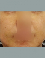 YUJIN Plastic Surgery & Aesthetic,Reviews,Images, Promotions, MISOODA — Korea cost, reviews & before-after | MISOODA