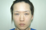 SEIN Aesthetic Plastic Surgery Clinic,Reviews,Images, Promotions — Korea cost, reviews & before-after | MISOODA