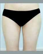 YUJIN Plastic Surgery & Aesthetic,Reviews,Images, Promotions, MISOODA — Korea cost, reviews & before-after | MISOODA
