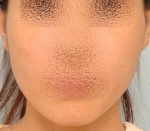SEIN Aesthetic Plastic Surgery Clinic,Reviews,Images, Promotions — Korea cost, reviews & before-after | MISOODA