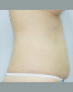 YUJIN Plastic Surgery & Aesthetic,Reviews,Images, Promotions, MISOODA — Korea cost, reviews & before-after | MISOODA
