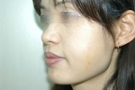 SEIN Aesthetic Plastic Surgery Clinic,Reviews,Images, Promotions — Korea cost, reviews & before-after | MISOODA