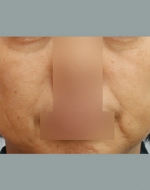 YUJIN Plastic Surgery & Aesthetic,Reviews,Images, Promotions, MISOODA — Korea cost, reviews & before-after | MISOODA