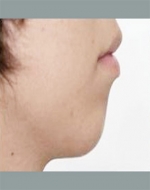 YUJIN Plastic Surgery & Aesthetic,Reviews,Images, Promotions, MISOODA — Korea cost, reviews & before-after | MISOODA
