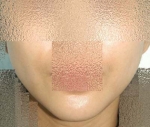 SEIN Aesthetic Plastic Surgery Clinic,Reviews,Images, Promotions — Korea cost, reviews & before-after | MISOODA