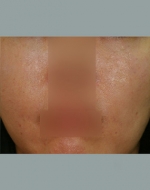 YUJIN Plastic Surgery & Aesthetic,Reviews,Images, Promotions, MISOODA — Korea cost, reviews & before-after | MISOODA