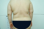 SEIN Aesthetic Plastic Surgery Clinic,Reviews,Images, Promotions — Korea cost, reviews & before-after | MISOODA
