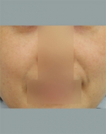 YUJIN Plastic Surgery & Aesthetic,Reviews,Images, Promotions, MISOODA — Korea cost, reviews & before-after | MISOODA