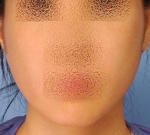 SEIN Aesthetic Plastic Surgery Clinic,Reviews,Images, Promotions — Korea cost, reviews & before-after | MISOODA