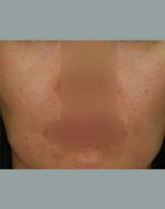 YUJIN Plastic Surgery & Aesthetic,Reviews,Images, Promotions, MISOODA — Korea cost, reviews & before-after | MISOODA