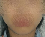 SEIN Aesthetic Plastic Surgery Clinic,Reviews,Images, Promotions — Korea cost, reviews & before-after | MISOODA