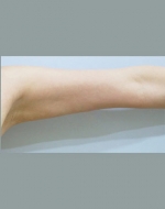YUJIN Plastic Surgery & Aesthetic,Reviews,Images, Promotions, MISOODA — Korea cost, reviews & before-after | MISOODA