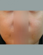 YUJIN Plastic Surgery & Aesthetic,Reviews,Images, Promotions, MISOODA — Korea cost, reviews & before-after | MISOODA
