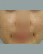 YUJIN Plastic Surgery & Aesthetic,Reviews,Images, Promotions, MISOODA — Korea cost, reviews & before-after | MISOODA