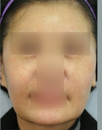 YUJIN Plastic Surgery & Aesthetic,Reviews,Images, Promotions, MISOODA — Korea cost, reviews & before-after | MISOODA