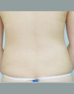 YUJIN Plastic Surgery & Aesthetic,Reviews,Images, Promotions, MISOODA — Korea cost, reviews & before-after | MISOODA