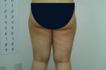 SEIN Aesthetic Plastic Surgery Clinic,Reviews,Images, Promotions — Korea cost, reviews & before-after | MISOODA