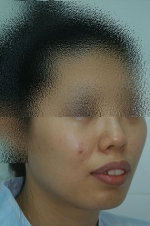 SEIN Aesthetic Plastic Surgery Clinic,Reviews,Images, Promotions — Korea cost, reviews & before-after | MISOODA
