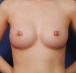breast