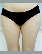 YUJIN Plastic Surgery & Aesthetic,Reviews,Images, Promotions, MISOODA — Korea cost, reviews & before-after | MISOODA