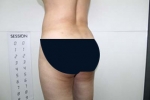 SEIN Aesthetic Plastic Surgery Clinic,Reviews,Images, Promotions — Korea cost, reviews & before-after | MISOODA