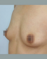 YUJIN Plastic Surgery & Aesthetic,Reviews,Images, Promotions, MISOODA — Korea cost, reviews & before-after | MISOODA