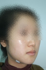 SEIN Aesthetic Plastic Surgery Clinic,Reviews,Images, Promotions — Korea cost, reviews & before-after | MISOODA
