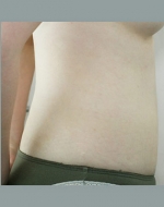 YUJIN Plastic Surgery & Aesthetic,Reviews,Images, Promotions, MISOODA — Korea cost, reviews & before-after | MISOODA