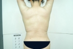 SEIN Aesthetic Plastic Surgery Clinic,Reviews,Images, Promotions — Korea cost, reviews & before-after | MISOODA