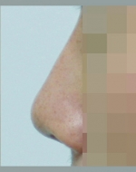 YUJIN Plastic Surgery & Aesthetic,Reviews,Images, Promotions, MISOODA — Korea cost, reviews & before-after | MISOODA