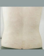 YUJIN Plastic Surgery & Aesthetic,Reviews,Images, Promotions, MISOODA — Korea cost, reviews & before-after | MISOODA