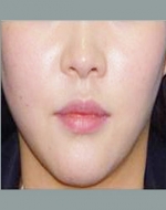 YUJIN Plastic Surgery & Aesthetic,Reviews,Images, Promotions, MISOODA — Korea cost, reviews & before-after | MISOODA