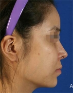 Mizain Aesthetic Clinic, Reviews,Images,Promotions — Korea cost, reviews & before-after | MISOODA