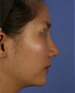 Mizain Aesthetic Clinic, Reviews,Images,Promotions — Korea cost, reviews & before-after | MISOODA