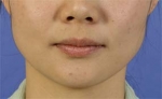 Mizain Aesthetic Clinic, Reviews,Images,Promotions — Korea cost, reviews & before-after | MISOODA