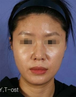 Mizain Aesthetic Clinic, Reviews,Images,Promotions — Korea cost, reviews & before-after | MISOODA