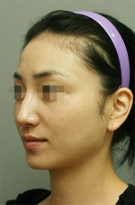 Mizain Aesthetic Clinic, Reviews,Images,Promotions — Korea cost, reviews & before-after | MISOODA