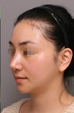 Mizain Aesthetic Clinic, Reviews,Images,Promotions — Korea cost, reviews & before-after | MISOODA