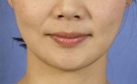 Mizain Aesthetic Clinic, Reviews,Images,Promotions — Korea cost, reviews & before-after | MISOODA