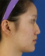 Mizain Aesthetic Clinic, Reviews,Images,Promotions — Korea cost, reviews & before-after | MISOODA