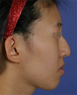 Mizain Aesthetic Clinic, Reviews,Images,Promotions — Korea cost, reviews & before-after | MISOODA