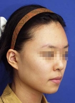 Mizain Aesthetic Clinic, Reviews,Images,Promotions — Korea cost, reviews & before-after | MISOODA