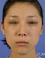 Mizain Aesthetic Clinic, Reviews,Images,Promotions — Korea cost, reviews & before-after | MISOODA
