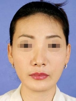 Mizain Aesthetic Clinic, Reviews,Images,Promotions — Korea cost, reviews & before-after | MISOODA