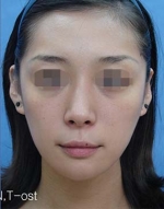 Mizain Aesthetic Clinic, Reviews,Images,Promotions — Korea cost, reviews & before-after | MISOODA