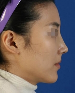 Mizain Aesthetic Clinic, Reviews,Images,Promotions — Korea cost, reviews & before-after | MISOODA