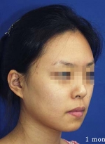 Mizain Aesthetic Clinic, Reviews,Images,Promotions — Korea cost, reviews & before-after | MISOODA