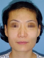 Mizain Aesthetic Clinic, Reviews,Images,Promotions — Korea cost, reviews & before-after | MISOODA