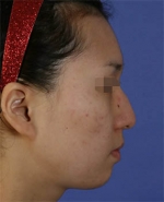 Mizain Aesthetic Clinic, Reviews,Images,Promotions — Korea cost, reviews & before-after | MISOODA